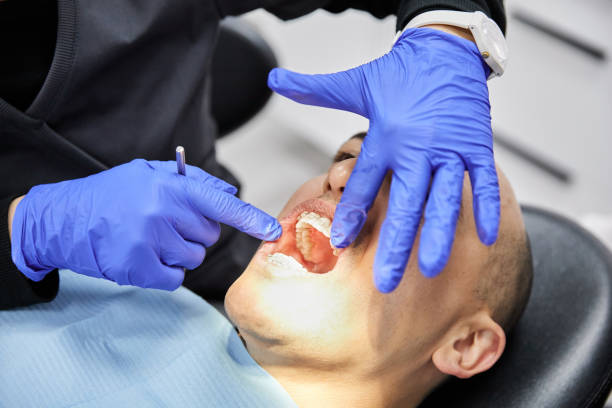 Best Emergency Gum Treatment in Cabana Colony, FL